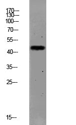 PAR1 (Cleaved-Ser42) Colorimetric Cell-Based ELISA Kit