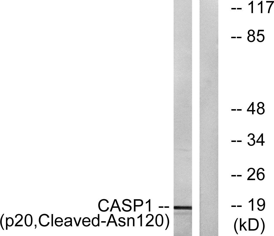Cleaved-Caspase-1 p20 (N120) Colorimetric Cell-Based ELISA Kit