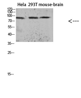 Tau (Acetyl-Lys174) Colorimetric Cell-Based ELISA Kit