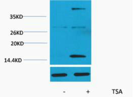 Histone H3 (Acetyl-Lys4) Colorimetric Cell-Based ELISA Kit
