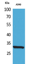 ATF-5 (Acetyl-Lys29) Colorimetric Cell-Based ELISA Kit