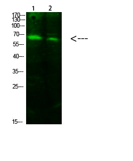 ACSS1 (Acetyl-K642) Colorimetric Cell-Based ELISA Kit