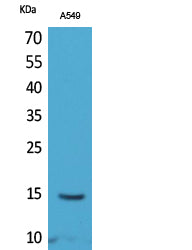 Histone H2B (Acetyl-Lys126) Colorimetric Cell-Based ELISA Kit