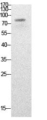 PCAF (Acetyl-Lys428) Colorimetric Cell-Based ELISA Kit