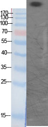 CBP (Acetyl-Lys1535) Colorimetric Cell-Based ELISA Kit