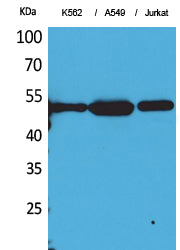 Tubulin alpha (Acetyl-Lys352) Colorimetric Cell-Based ELISA Kit