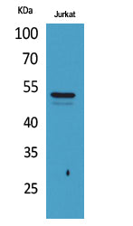 Tubulin alpha (Acetyl-Lys40) Colorimetric Cell-Based ELISA Kit