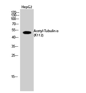 Tubulin alpha (Acetyl-Lys112) Colorimetric Cell-Based ELISA Kit