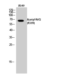 Nrf2 (Acetyl-Lys599) Colorimetric Cell-Based ELISA Kit