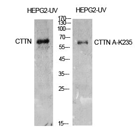 Cortactin (Acetyl-Lys235) Colorimetric Cell-Based ELISA Kit