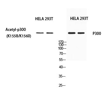 p300 (Acetyl-Lys1558/Acetyl-Lys1560) Colorimetric Cell-Based ELISA Kit