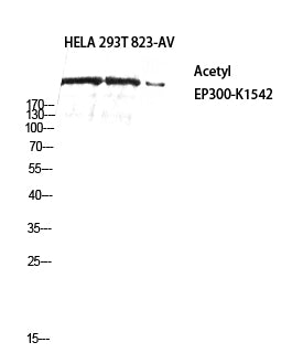 p300 (Acetyl-Lys1542) Colorimetric Cell-Based ELISA Kit