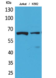 NFκB-p65 (Acetyl-Lys218) Colorimetric Cell-Based ELISA Kit