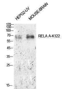 NFκB-p65 (Acetyl-Lys122) Colorimetric Cell-Based ELISA Kit