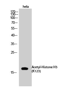 Histone H3 (Acetyl-Lys123) Colorimetric Cell-Based ELISA Kit
