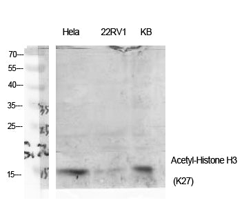 Histone H3 (Acetyl-Lys27) Colorimetric Cell-Based ELISA Kit