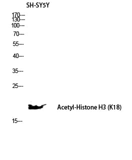 Histone H3 (Acetyl-Lys18) Colorimetric Cell-Based ELISA Kit