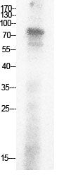 Ub (Acetyl-Lys29) Colorimetric Cell-Based ELISA Kit