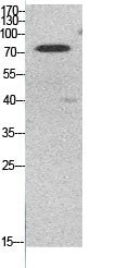 Ub (Acetyl-Lys48) Colorimetric Cell-Based ELISA Kit