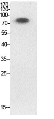 Ub (Acetyl-Lys33) Colorimetric Cell-Based ELISA Kit