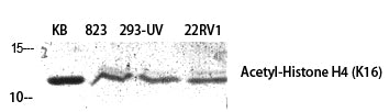 Histone H4 (Acetyl-Lys16) Colorimetric Cell-Based ELISA Kit