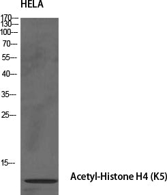 Histone H4 (Acetyl-Lys5) Colorimetric Cell-Based ELISA Kit