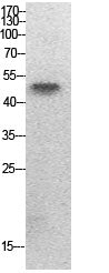 PTEN (Acetyl-Lys402) Colorimetric Cell-Based ELISA Kit