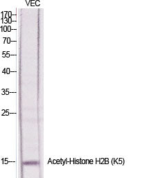 Histone H2B (Acetyl-Lys5) Colorimetric Cell-Based ELISA Kit