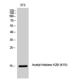 Histone H2B (Acetyl-Lys15) Colorimetric Cell-Based ELISA Kit