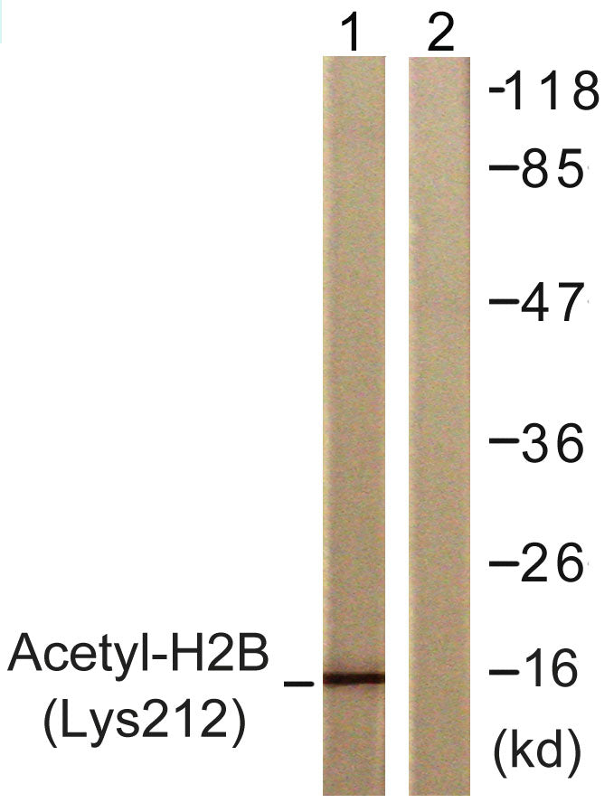 Acetyl Histone H2B (K12) Colorimetric Cell-Based ELISA Kit