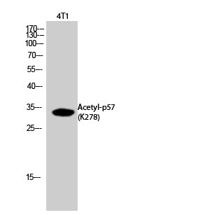 p57 (Acetyl-Lys278) Colorimetric Cell-Based ELISA Kit