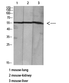 HNF-4alpha/gamma (Acetyl-Lys127/79) Colorimetric Cell-Based ELISA Kit