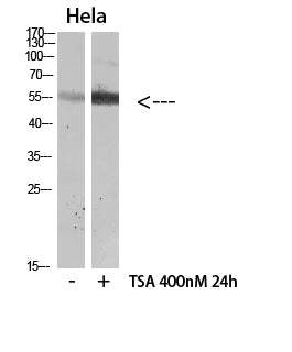 HNF-4alpha (Acetyl-Lys106) Colorimetric Cell-Based ELISA Kit
