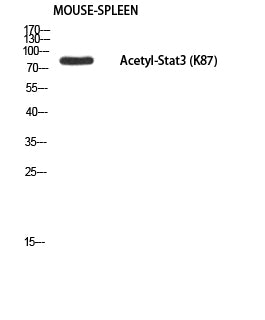 Stat3 (Acetyl-Lys87) Colorimetric Cell-Based ELISA Kit