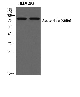Tau (Acetyl-Lys686) Colorimetric Cell-Based ELISA Kit