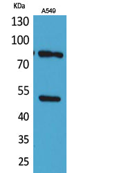 HSP 90 (Acetyl-Lys435) Colorimetric Cell-Based ELISA Kit
