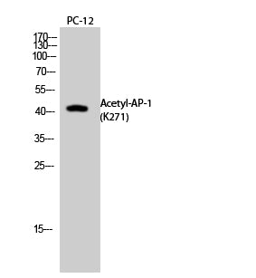 AP-1 (Acetyl-Lys271) Colorimetric Cell-Based ELISA Kit