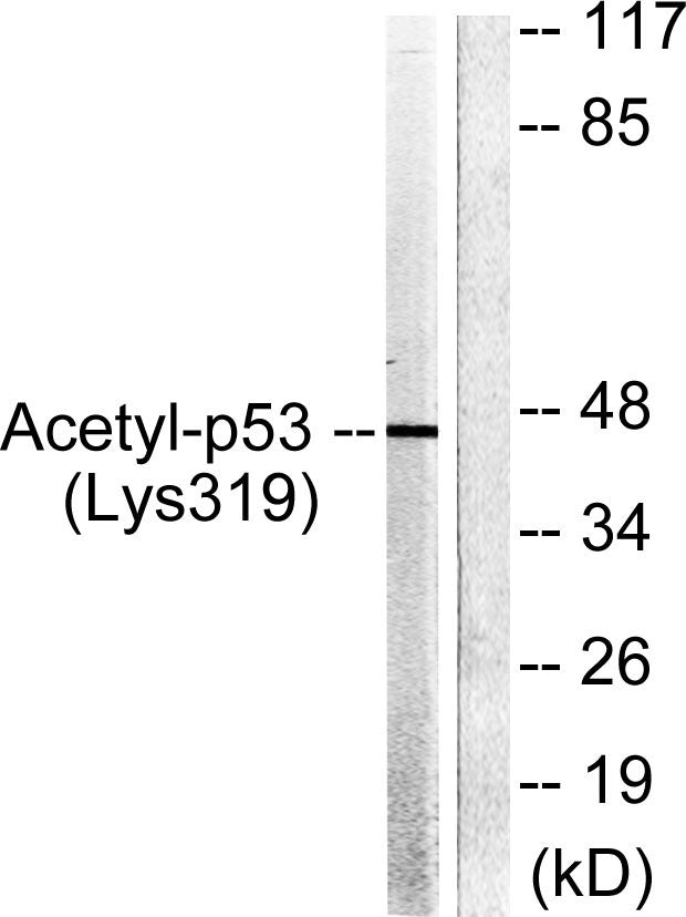 Acetyl p53 (K319) Colorimetric Cell-Based ELISA Kit
