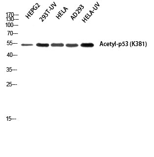 p53 (Acetyl-Lys381) Colorimetric Cell-Based ELISA Kit