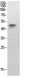 p53 (Acetyl-Lys320) Colorimetric Cell-Based ELISA Kit