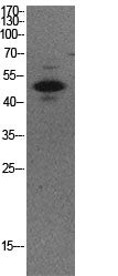 p53 (Acetyl-Lys373) Colorimetric Cell-Based ELISA Kit