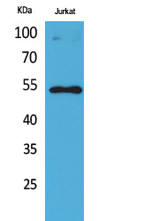 p53 (Acetyl-Lys372) Colorimetric Cell-Based ELISA Kit