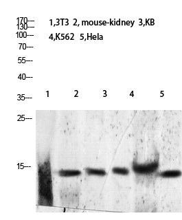 Histone H2B (Acetyl-Lys24/25) Colorimetric Cell-Based ELISA Kit