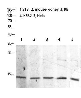 Histone H2B (Acetyl-Lys21) Colorimetric Cell-Based ELISA Kit