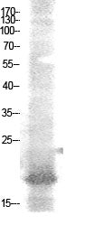 NF-E4 (Acetyl-Lys43) Colorimetric Cell-Based ELISA Kit