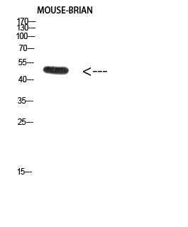 E2F-1 (Acetyl-Lys120) Colorimetric Cell-Based ELISA Kit
