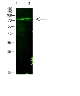 E2F-1 (Acetyl-K125) Colorimetric Cell-Based ELISA Kit