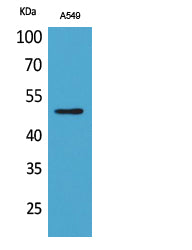 EF-1 alpha1/2 (Acetyl-Lys41) Colorimetric Cell-Based ELISA Kit