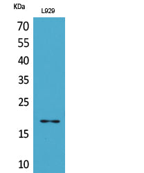 Acetyl eIF5A/eIF5A2 (K47) Colorimetric Cell-Based ELISA Kit