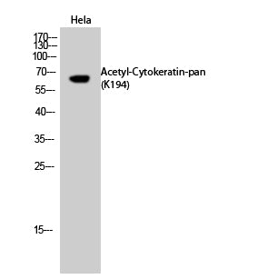 Cytokeratin-pan (Acetyl-Lys194) Colorimetric Cell-Based ELISA Kit